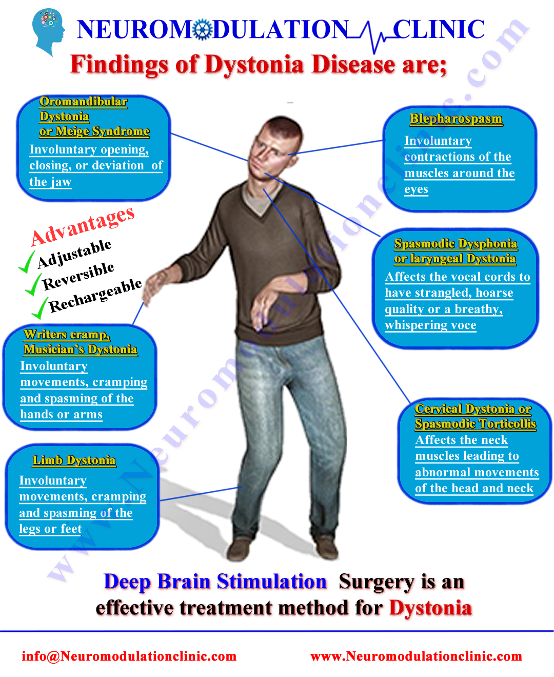 DYSTONIA