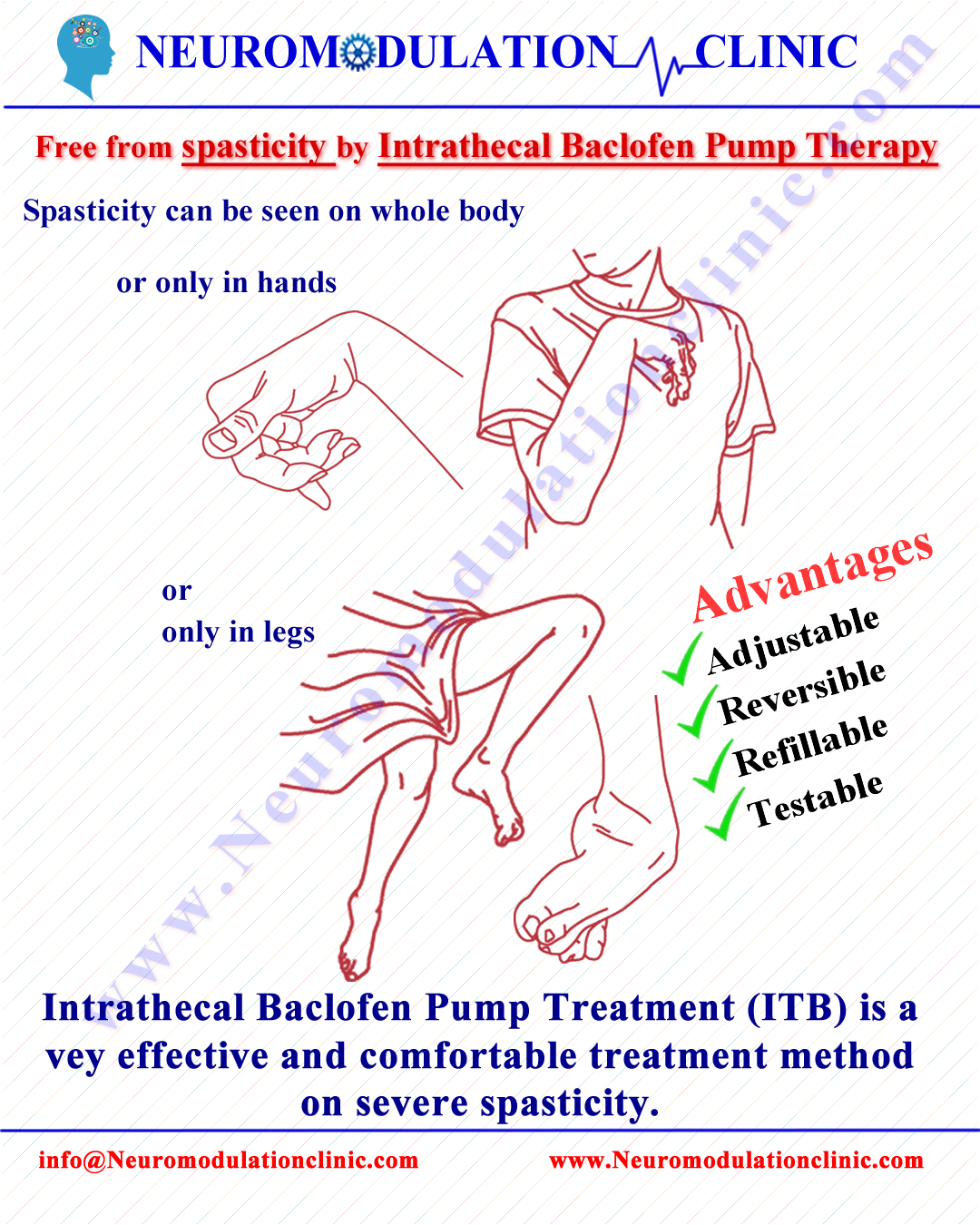 SPASTICITY