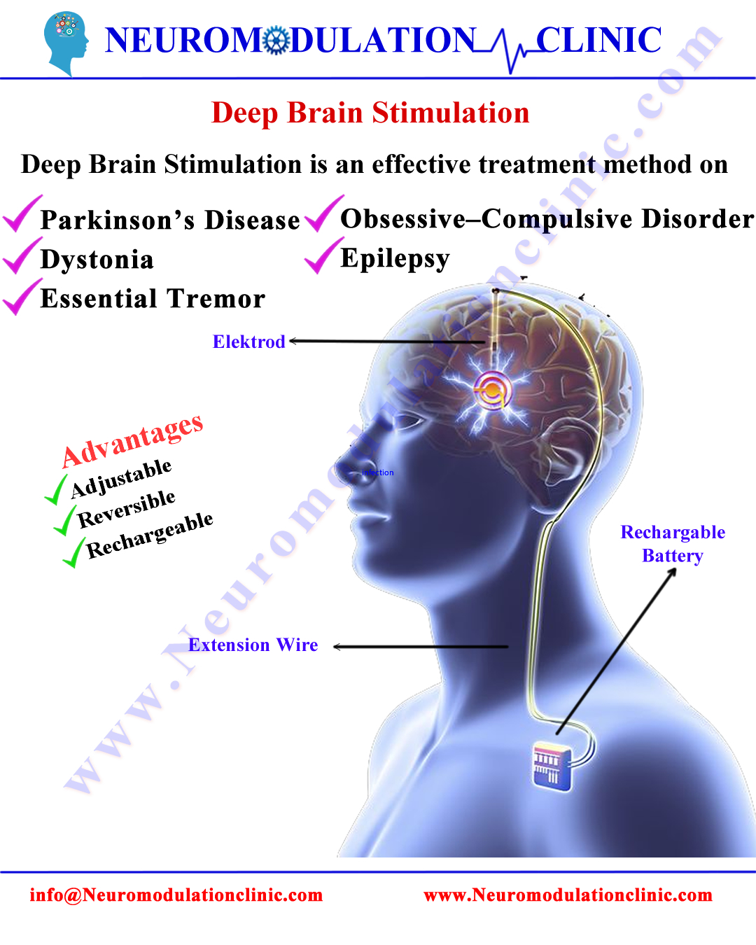 DEEP BRAIN STIMULATION