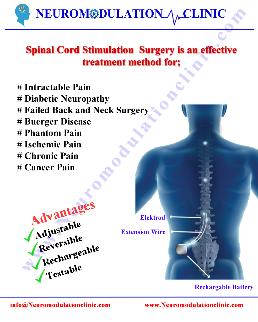 SPINAL CORD STIMULATION